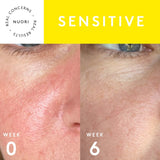 PROTECT+ FACIAL CREAM Skincare Nuori