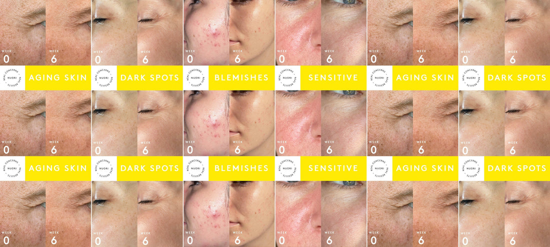 Real Concerns, Real Results: Addressing Top Skincare Concerns Naturally