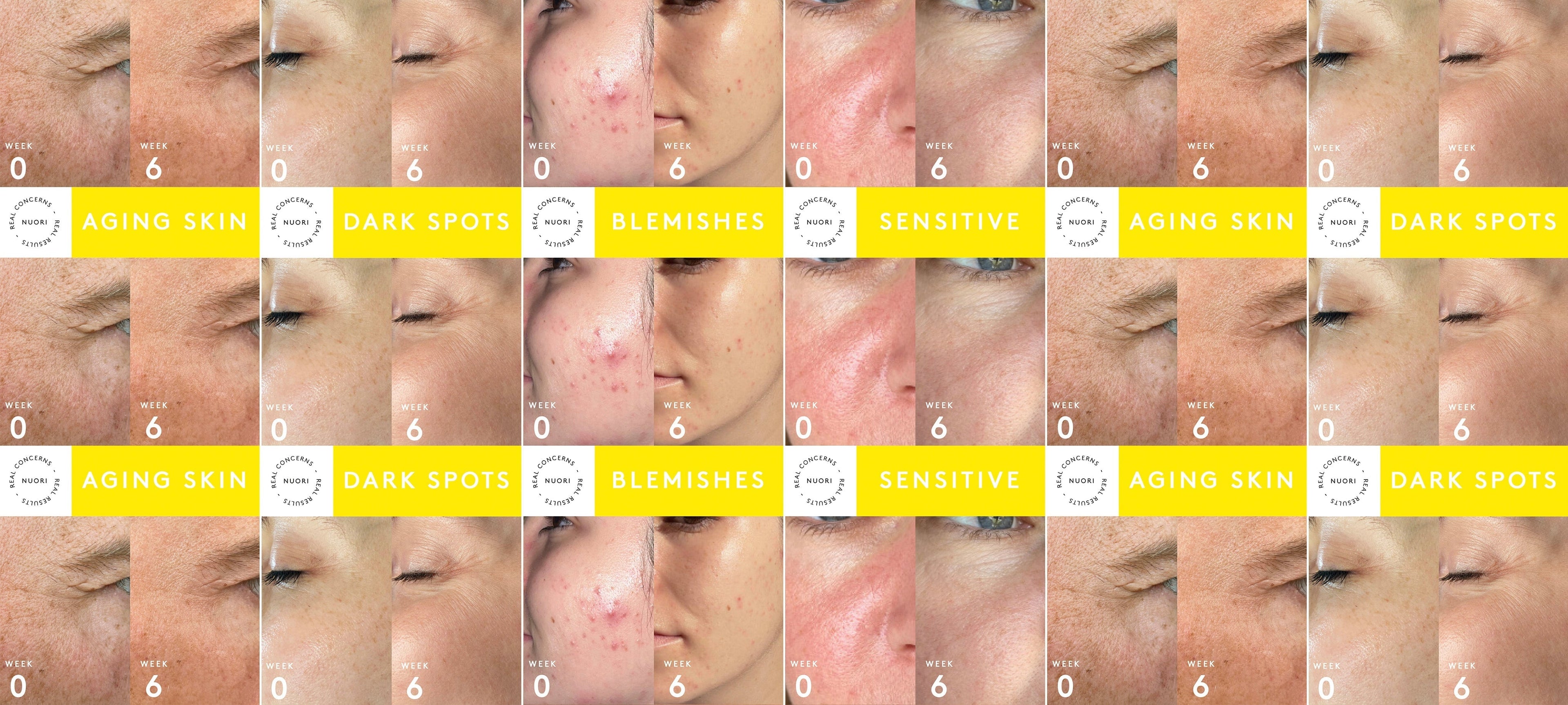 Real Concerns, Real Results: Addressing Top Skincare Concerns Naturally