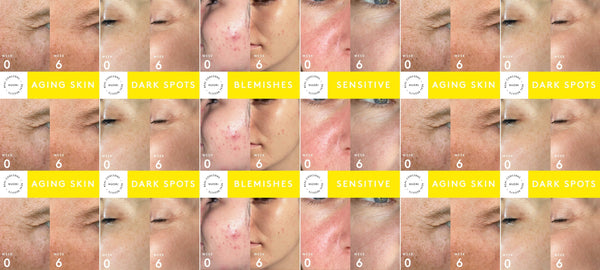 Real Concerns, Real Results: Addressing Top Skincare Concerns Naturally