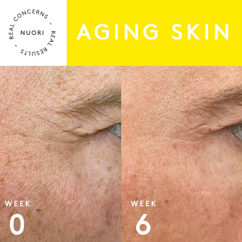 Aging Skin TRIO Set NUORI 